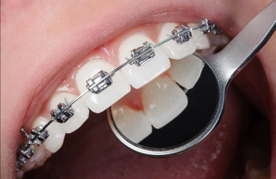 Zen Dental Center
