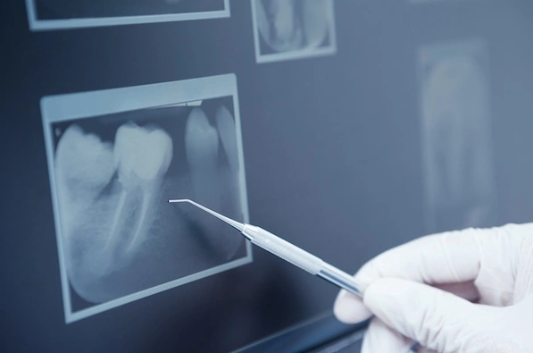 Seattle's Capitol Hill Dentist