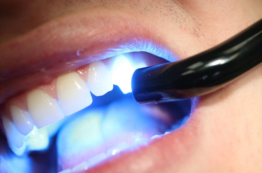 Seattle's Capitol Hill Dentist