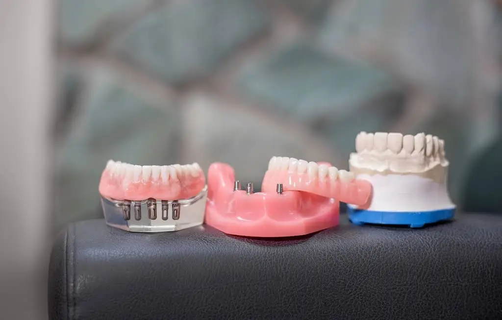 Mercer Island Dental