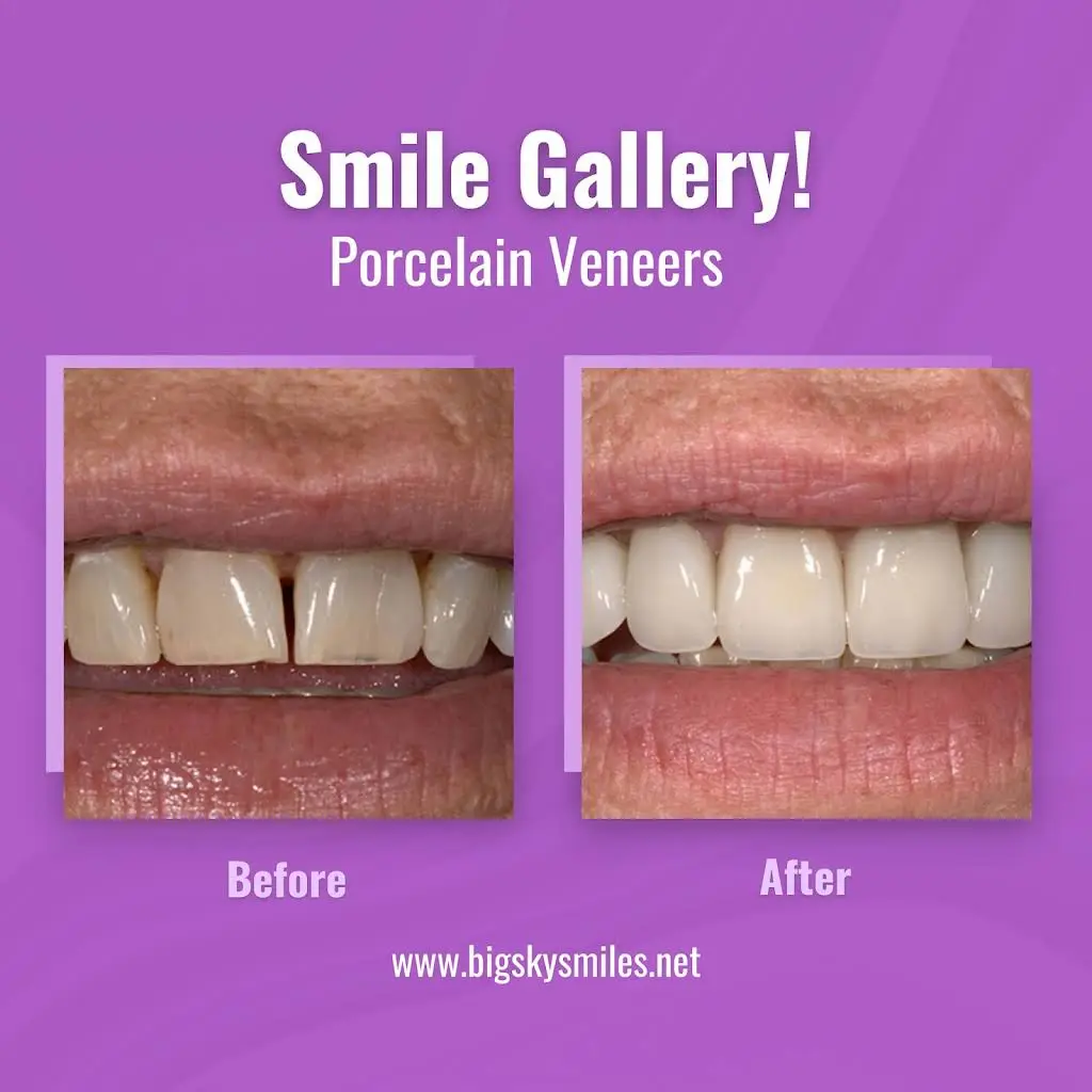 Thomas Smile Designs