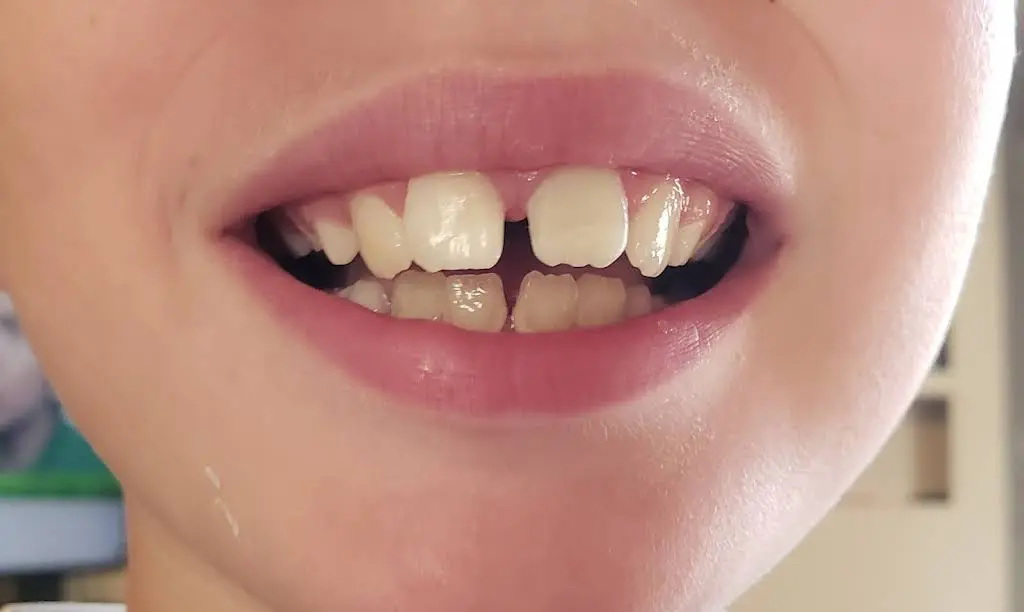 Northwest Smile Design