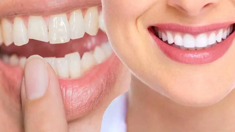 Lakeside Endodontics