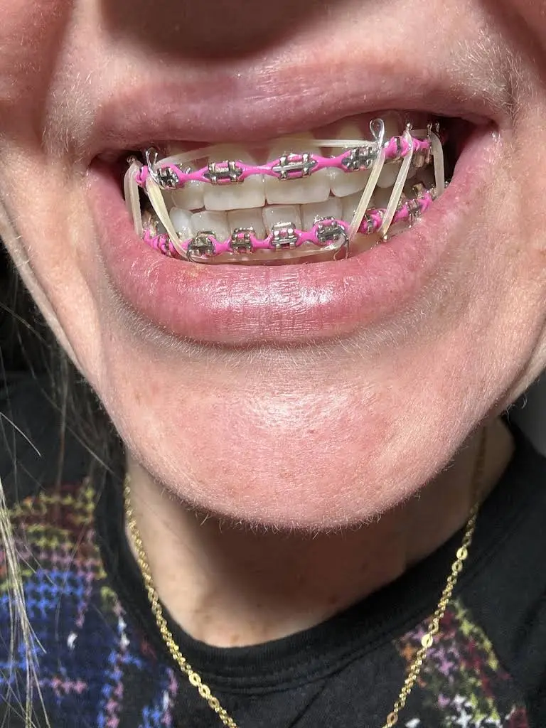 Hollevoet & Welk Orthodontics
