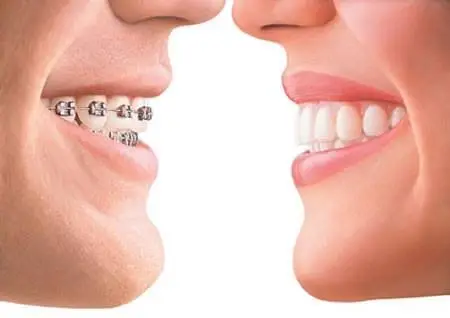 Smiles of Bellevue