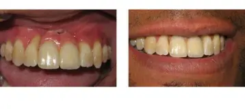 Washington State Prosthodontics