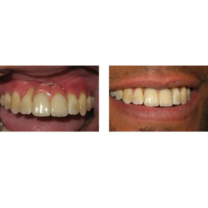 Washington State Prosthodontics