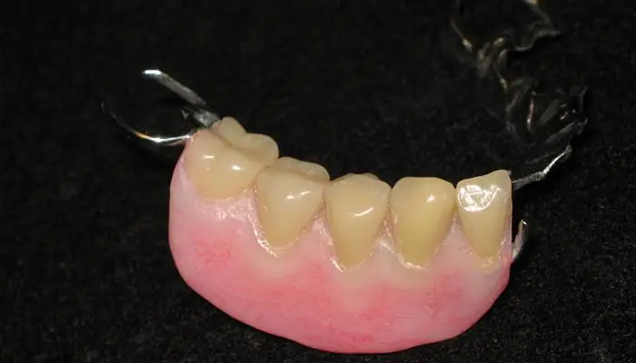 Washington State Prosthodontics
