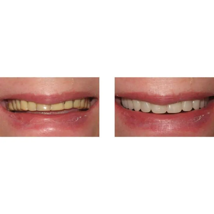 Washington State Prosthodontics