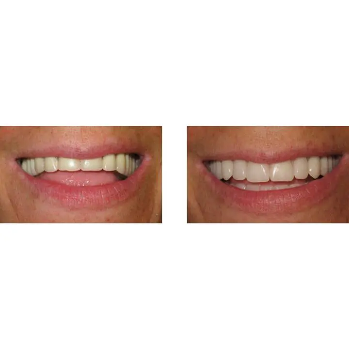 Washington State Prosthodontics