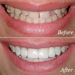 Washington State Prosthodontics