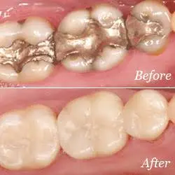 Washington State Prosthodontics