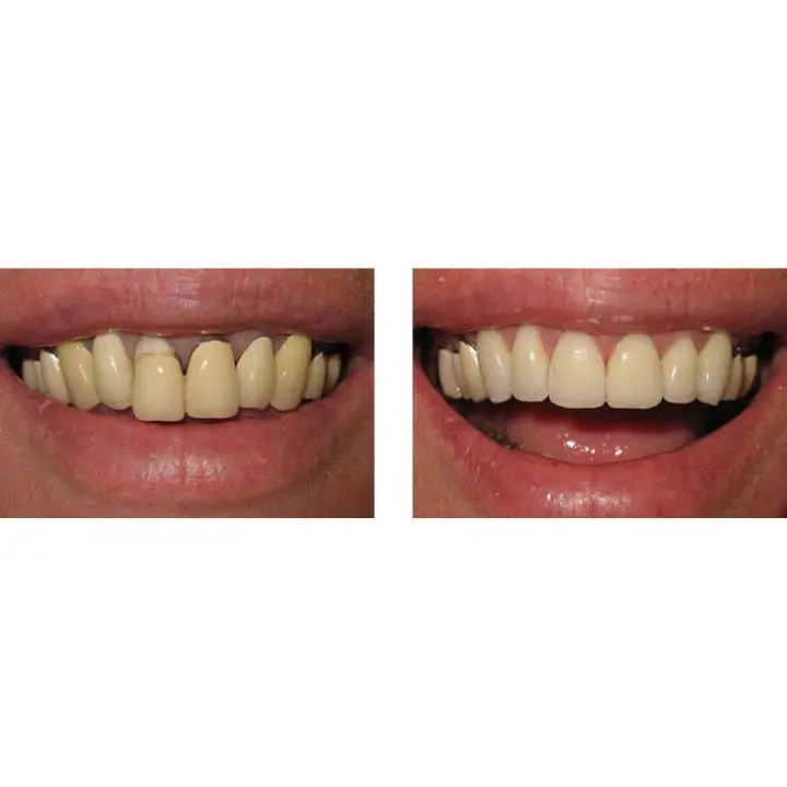 Washington State Prosthodontics