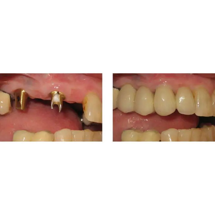 Washington State Prosthodontics