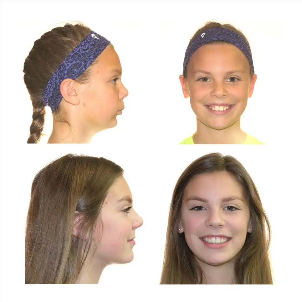 Dr. Dona Seely Orthodontics