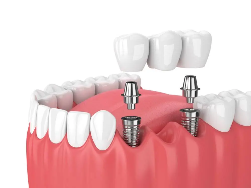 Seattle Oral Care