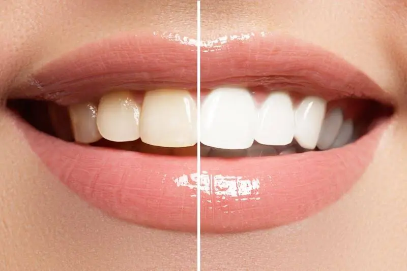 Seattle Oral Care