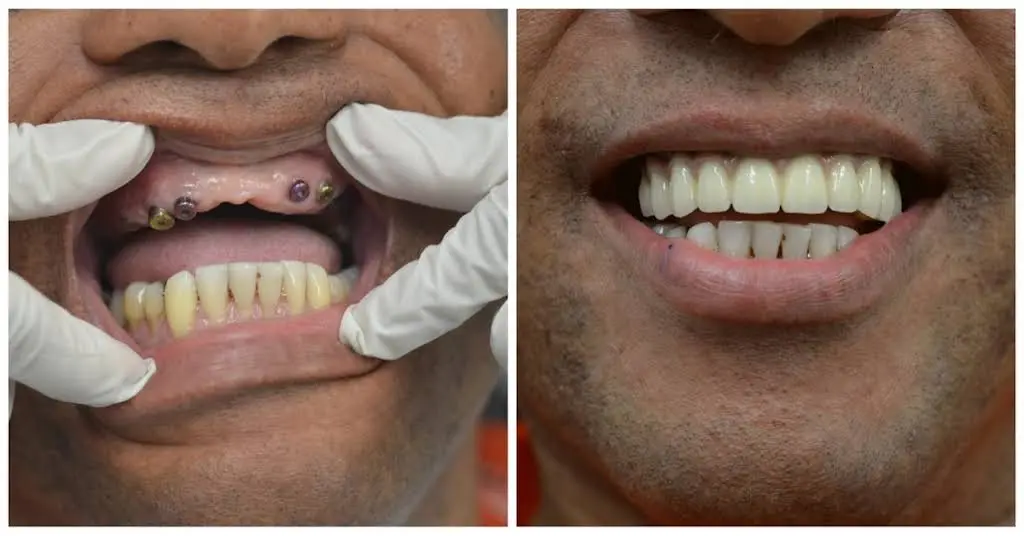 Total Care Dental
