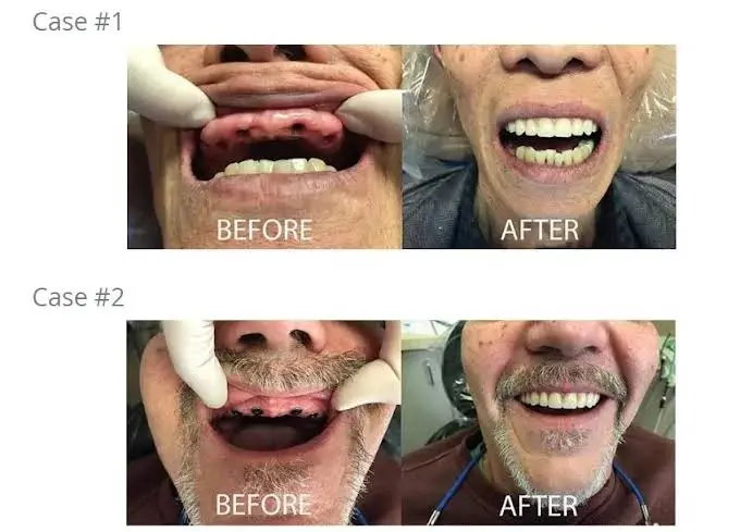 Total Care Dental