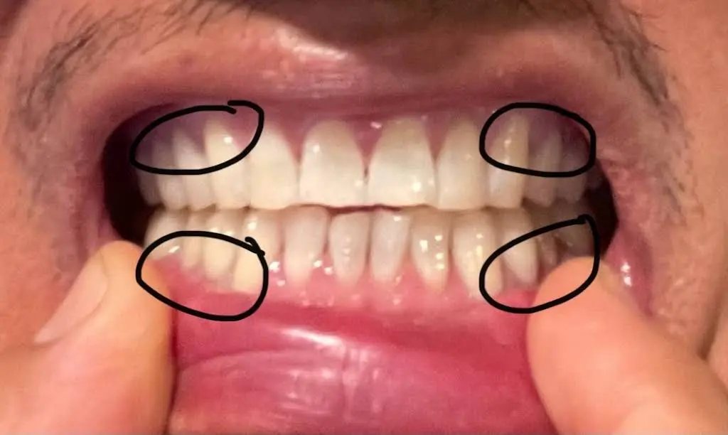 Cooley Smiles - Lynnwood