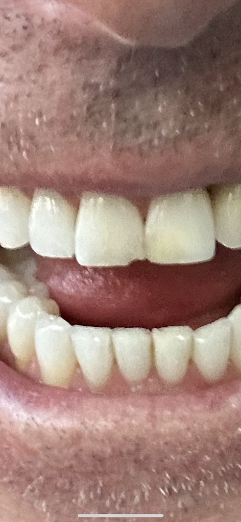 Cooley Smiles - Lynnwood