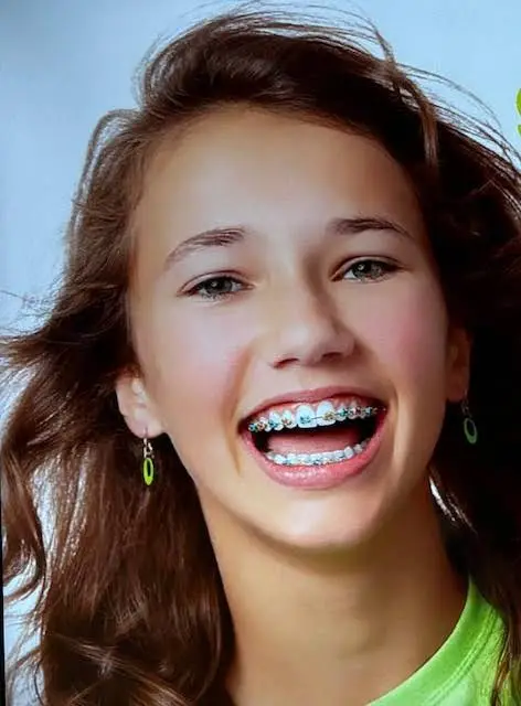 Dr. Y. Jennifer Choi Orthodontics