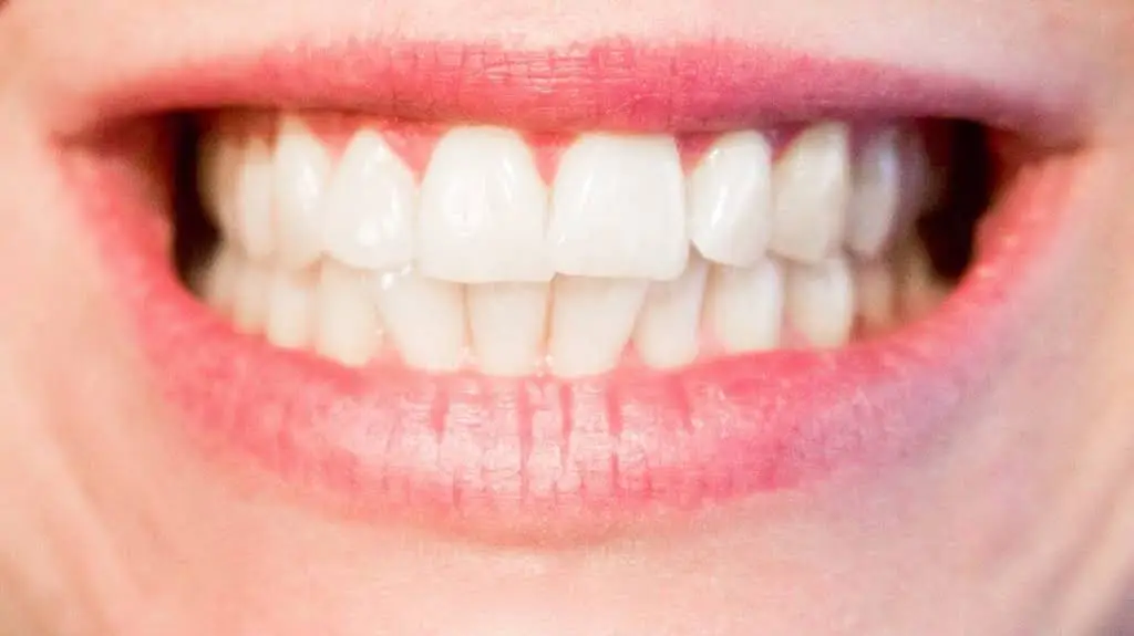 Sunrise Dental Bonney Lake