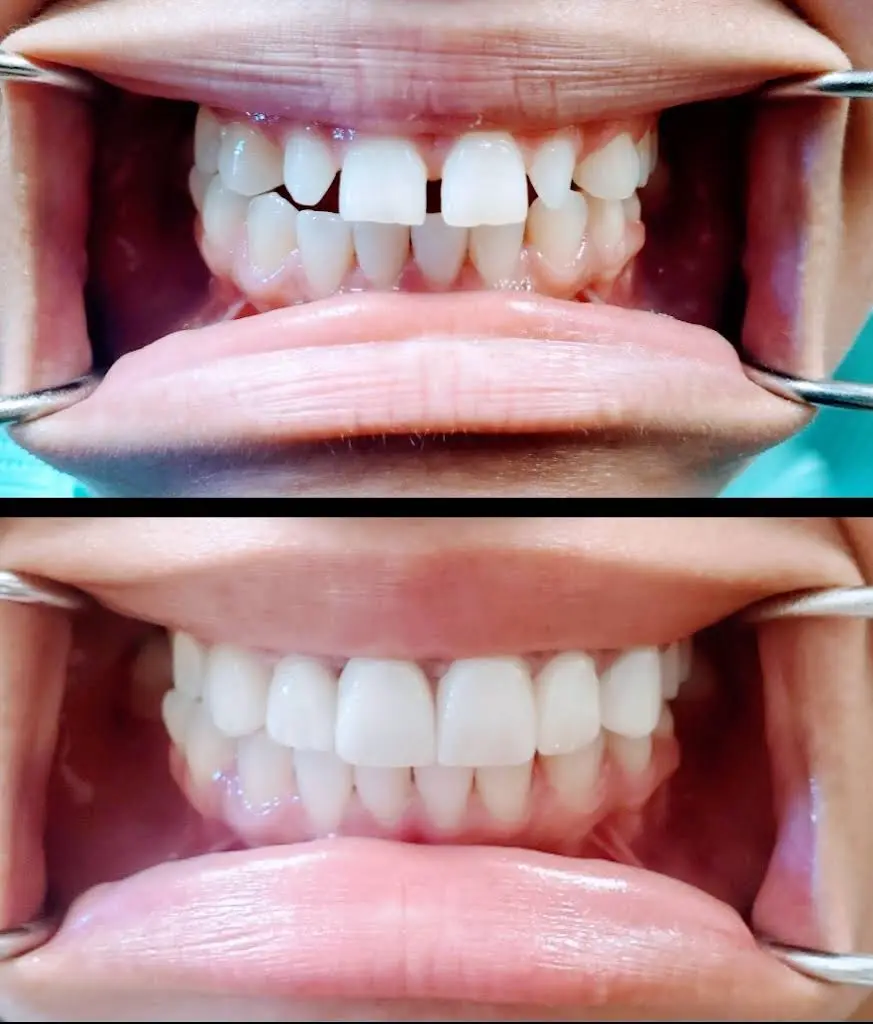Auburn Dental Smiles