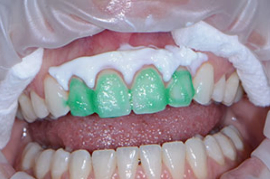 Atrium Dental Studio - Capitol Hill