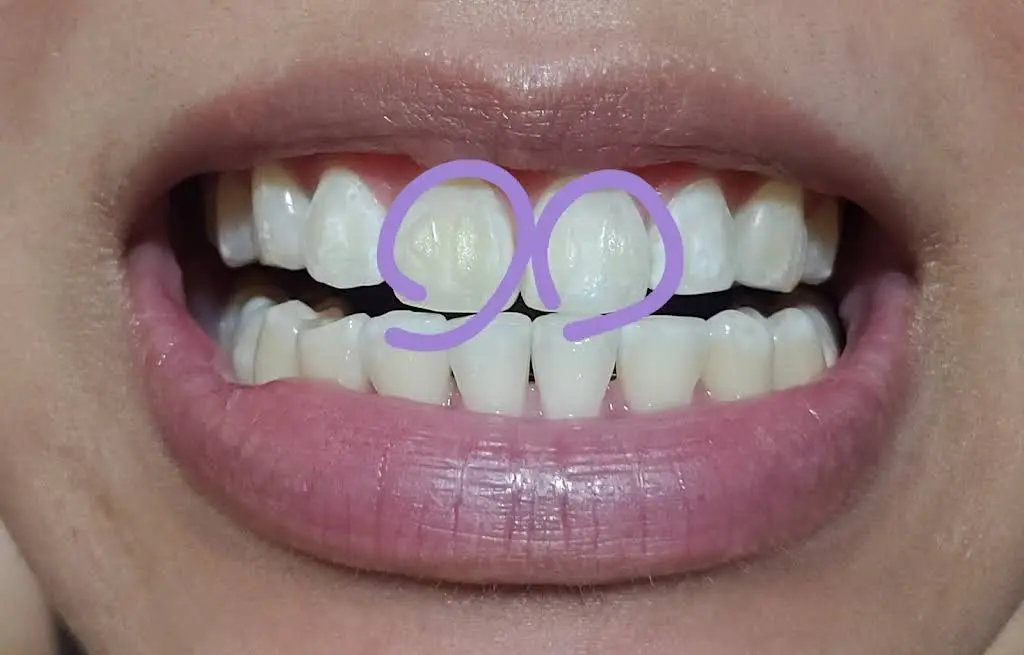 Pacific Coast Dentist: Navneet Sekhon DDS
