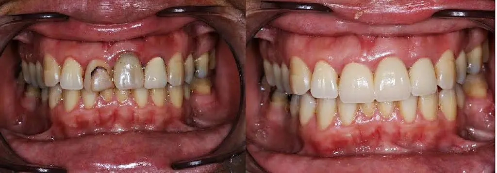 Advanced Care Dental