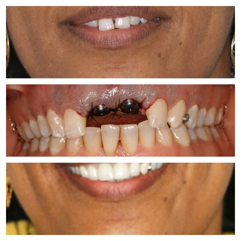 Advanced Care Dental