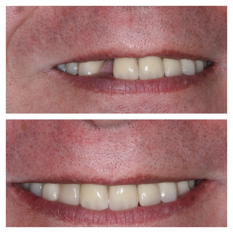 Advanced Care Dental