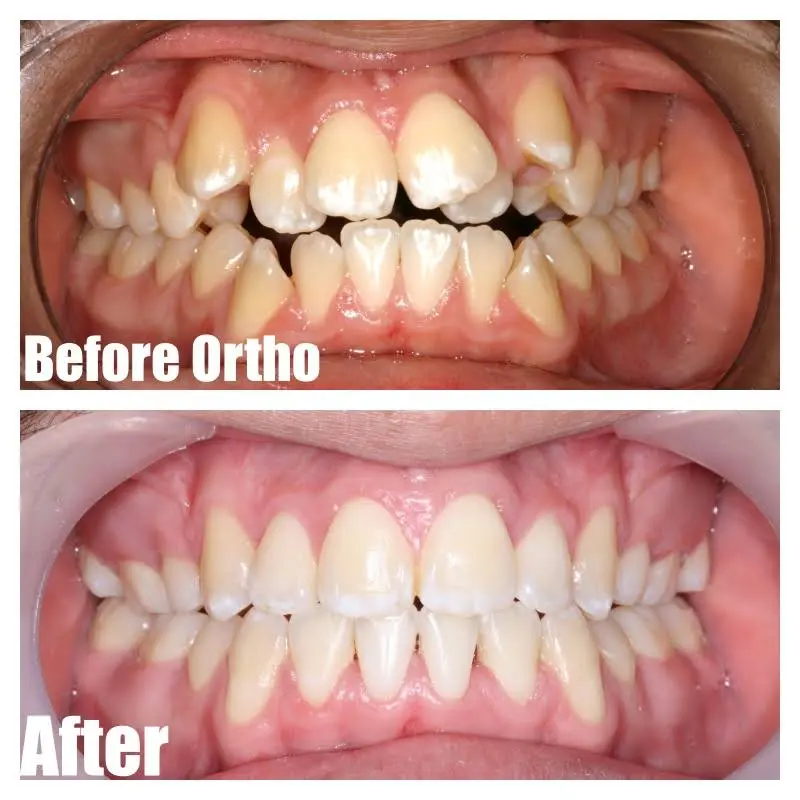 Advanced Care Dental