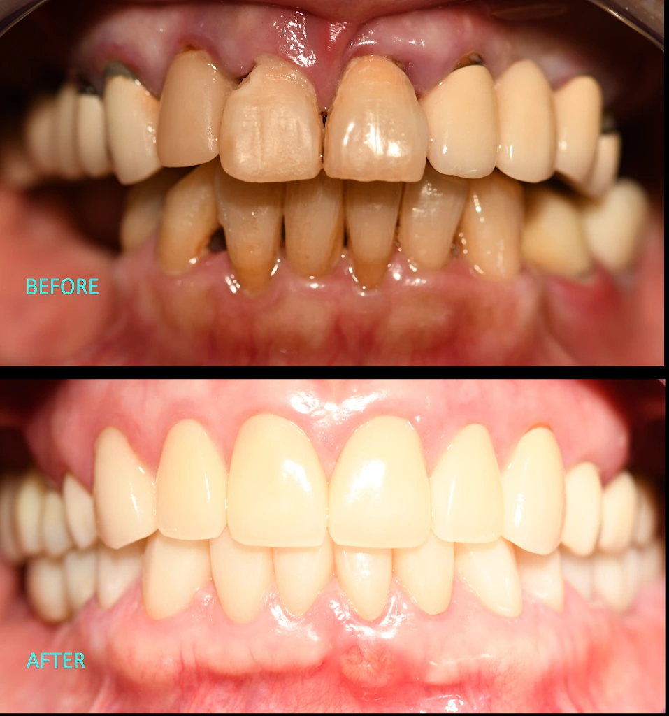 Advanced Implant Dental