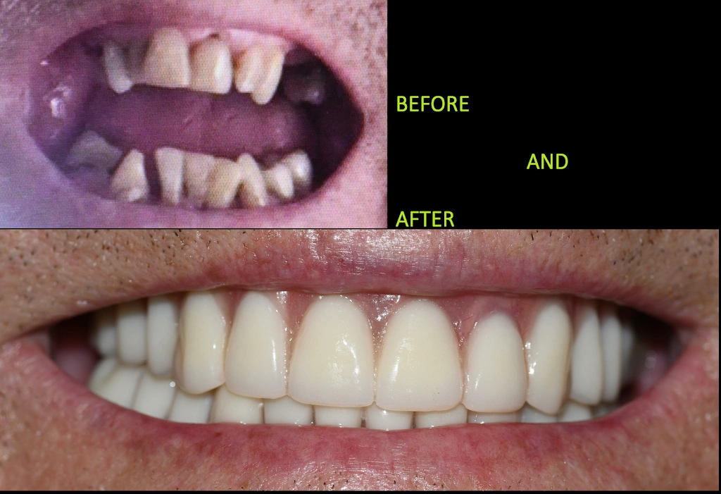 Advanced Implant Dental