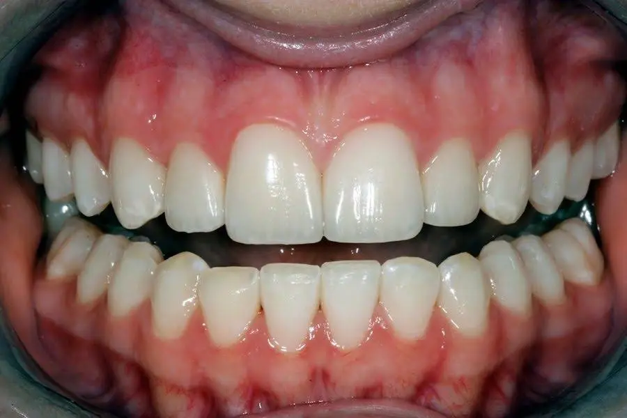River Valley Advanced Dental & Implant Center