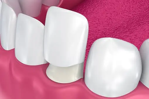 Grove Street Family Dentistry - Tania Tran, DMD