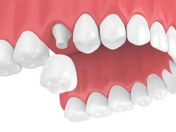 Grove Street Family Dentistry - Tania Tran, DMD