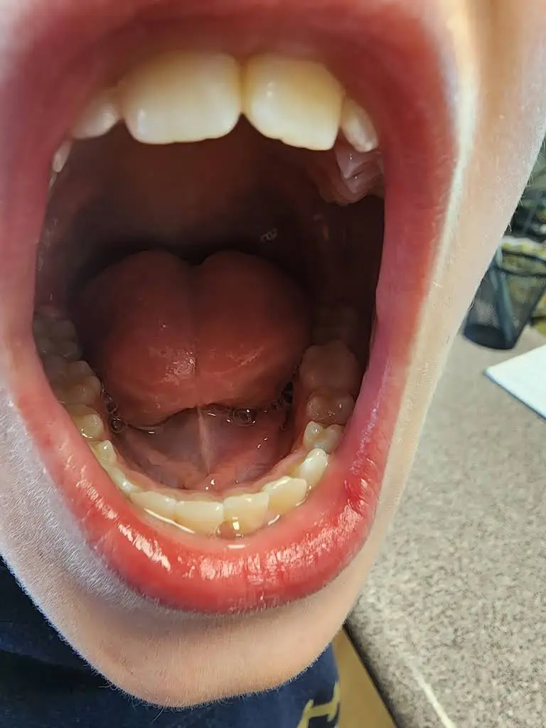Dentistry at Marysville - Implant, Cosmetic, and Family Dentistry