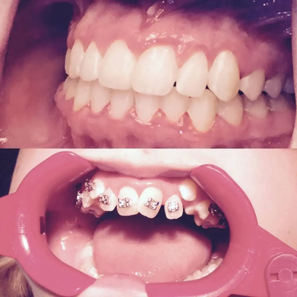 Marysville Orthodontics