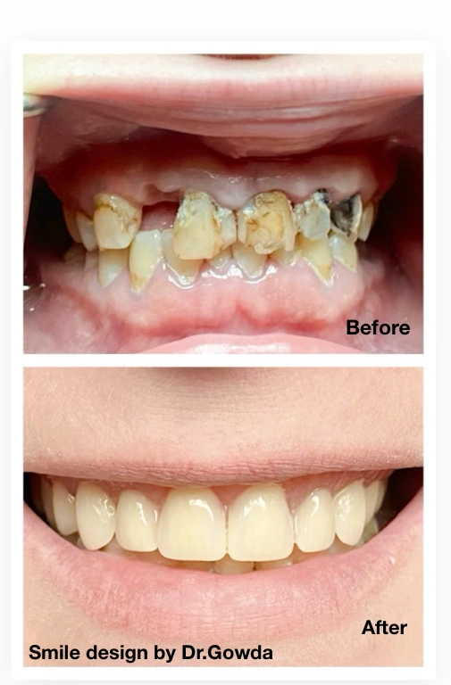 Perfect Smiles Dentistry