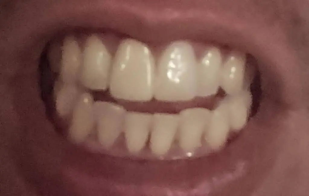 Avila Dental