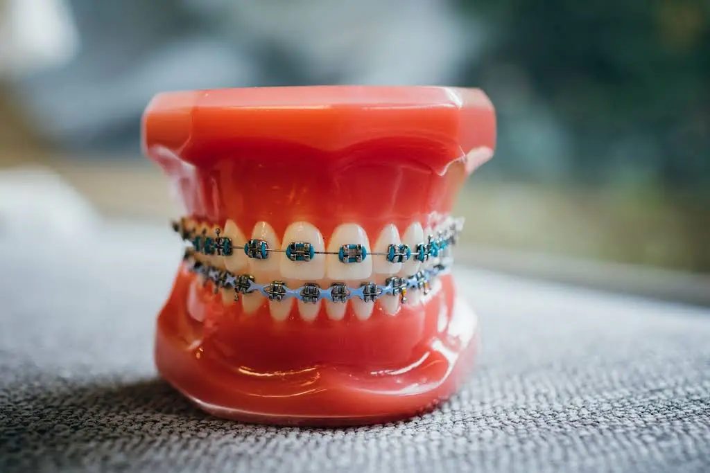 Amrit Burn Orthodontics