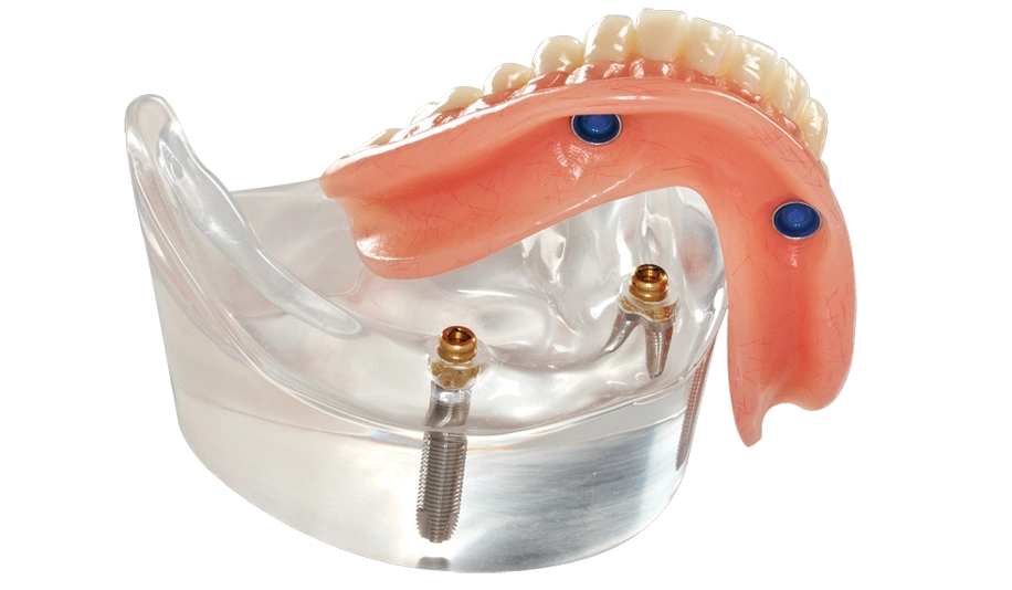 Comfy Denture & Hearing Clinic - Federal Way