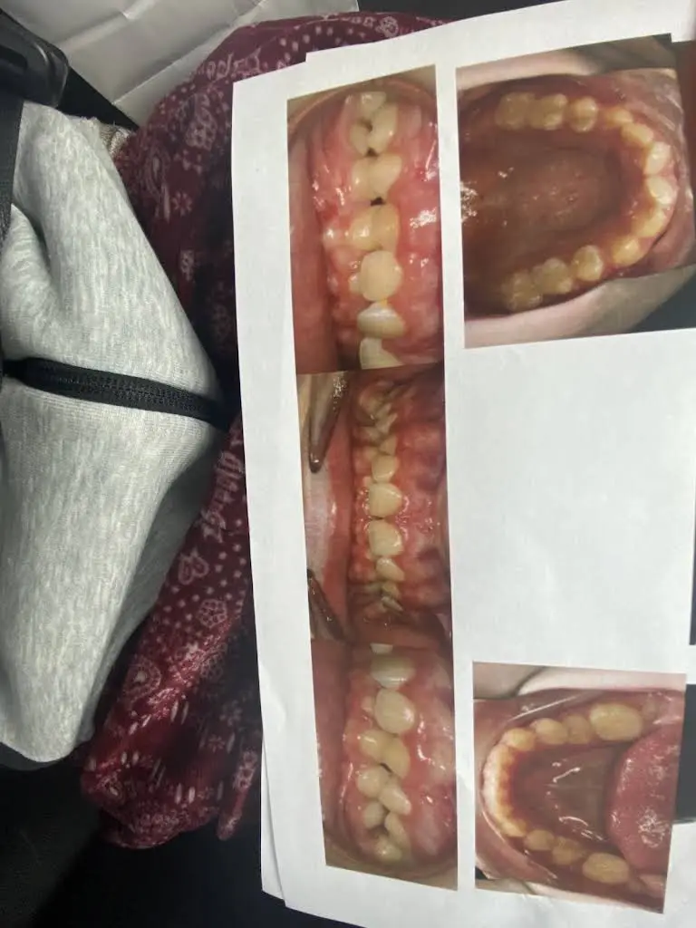 Brewer Dental Orthodontic & Pediatric Center