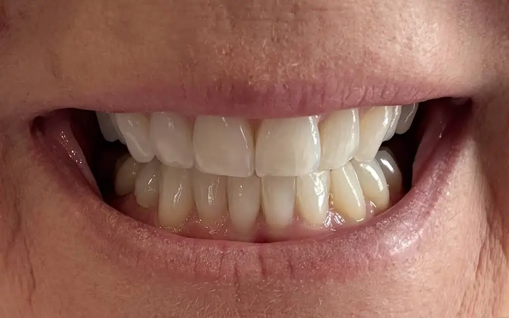 Dr. Spencer Zaugg, Family & Implant Dentistry
