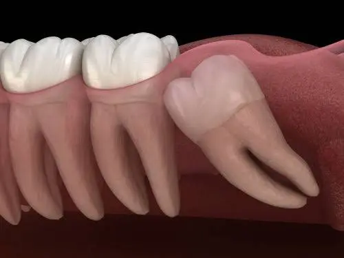 Sunrise Dental Everett
