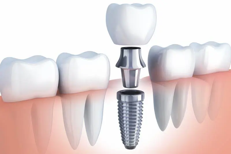 230 CV Dental