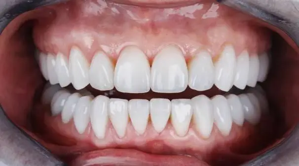 Harbour Pointe Dental Arts